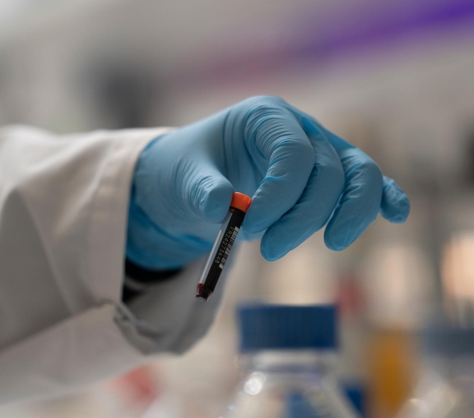 gloved hand is holding a sample vial with a small amount of blood contained. the glove is blue and the person is wearing a labcoat with the edge of a white sleeve visible
